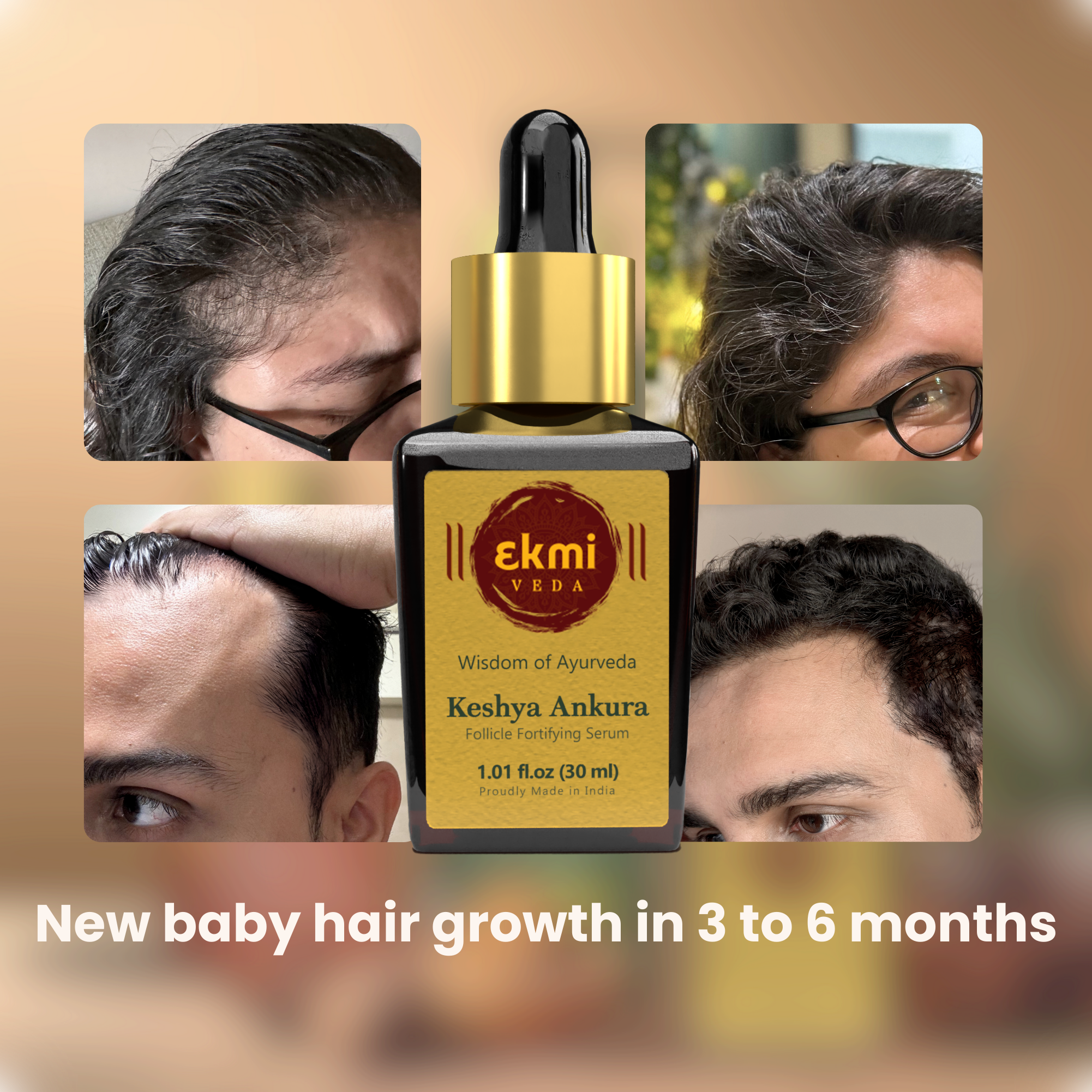Keshya Ankura Follicle stimulating serum